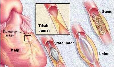 http://bilelimmi.com/wp-content/uploads/2013/11/anjiyo1.jpg