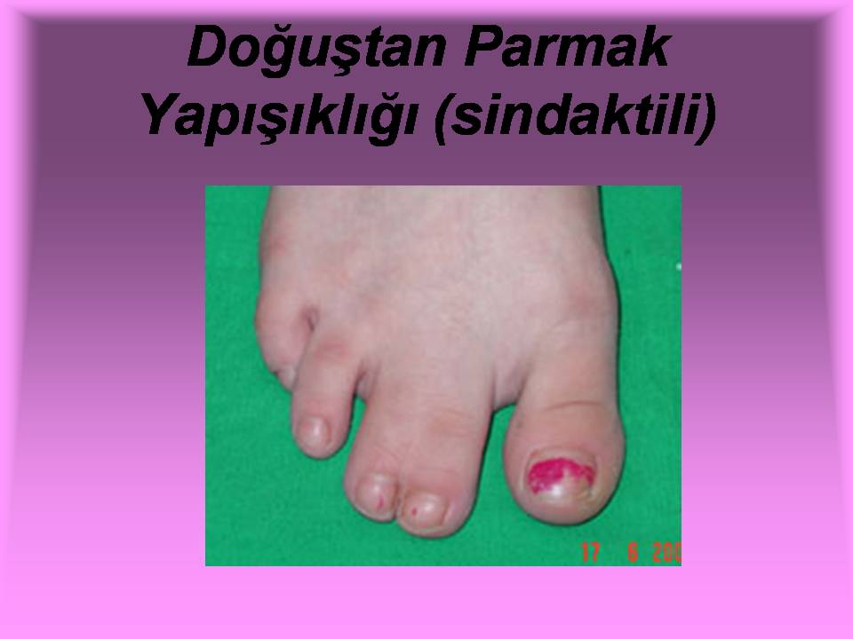 http://okul.erguven.net/dosya/www.erguven.net-Slayt1715.JPG